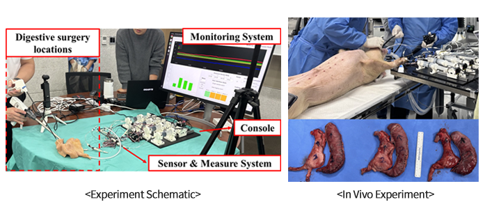위소매절제술 보조 장치 설계 및 제작 메인 이미지
